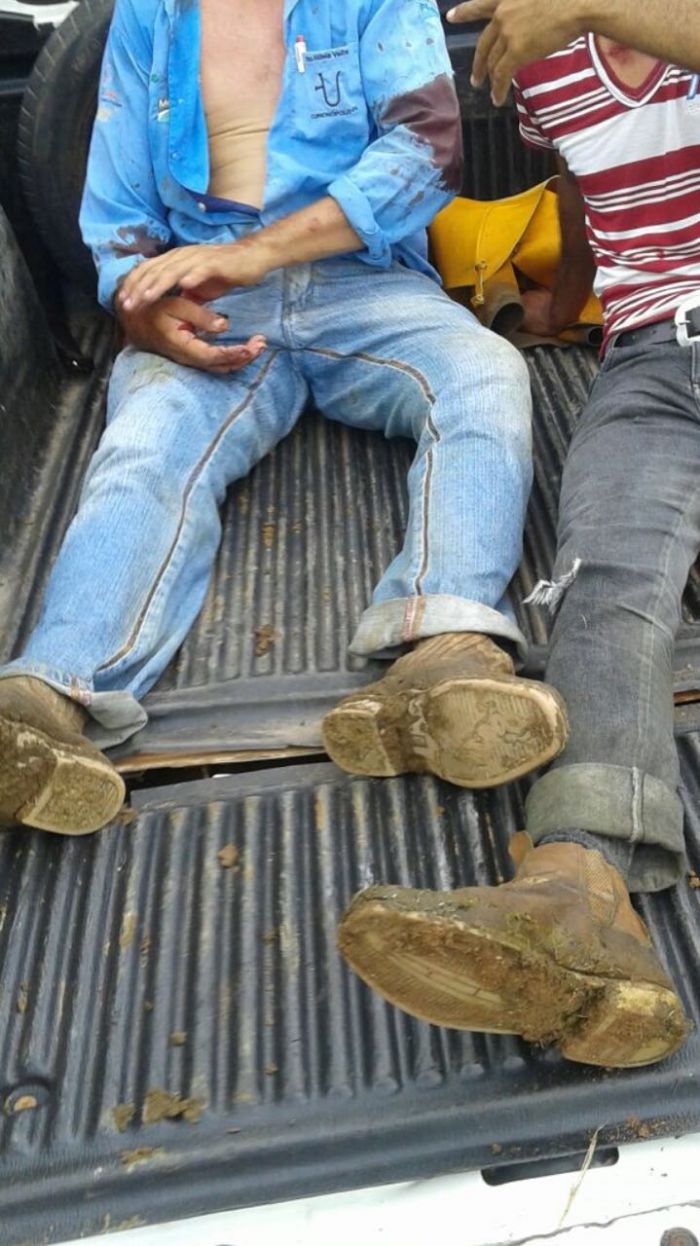 Funcionários baleados durante invasão de MST a fazenda no Pará