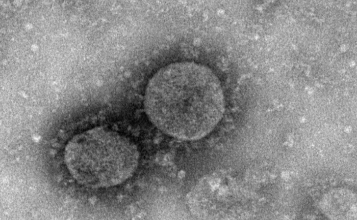 Coronavírus o vírus